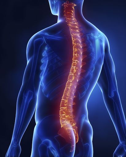Spondylosis